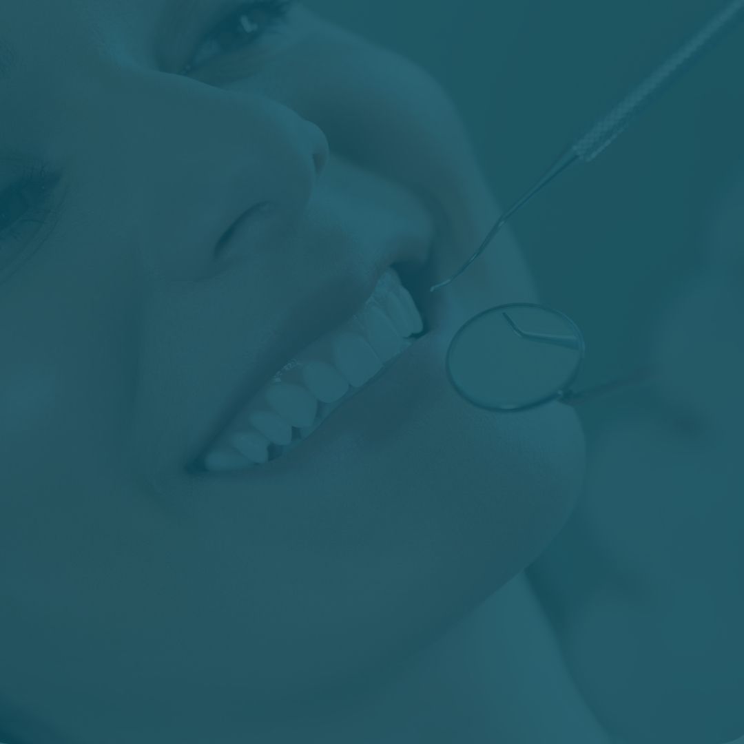 Cleaning & Prevention